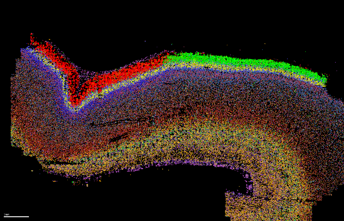 Spatial transcriptomics reveals the cell type and cytoarchitecture of the developing human cortex at single-cell resolution.