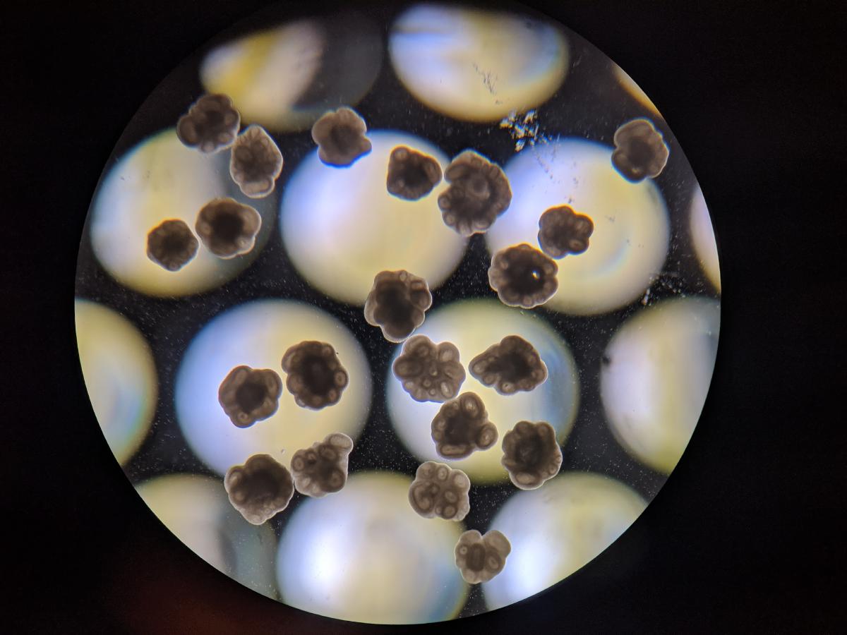 Brain organoids provide a tractable experimental model to study human brain development.